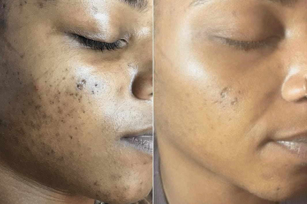 A result from Body+Beauty Lab