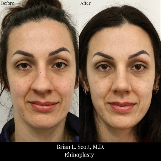 A result from Brian L. Scott, MD