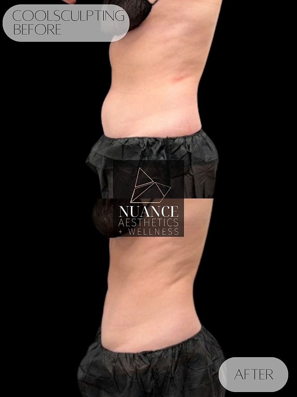 A result from Nuance Aesthetics