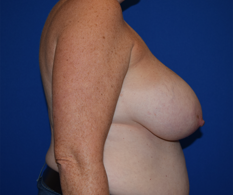 DePerro Plastic Surgery provider photo