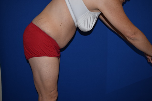 DePerro Plastic Surgery provider photo