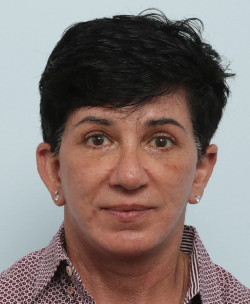 A result from Vitenas Cosmetic Surgery