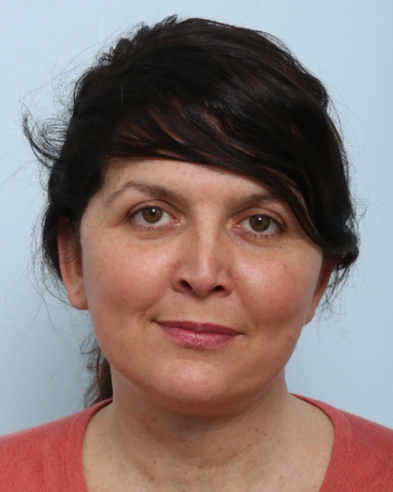 A result from Vitenas Cosmetic Surgery