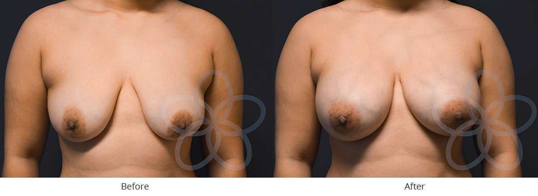 Newvue Plastic Surgery provider photo