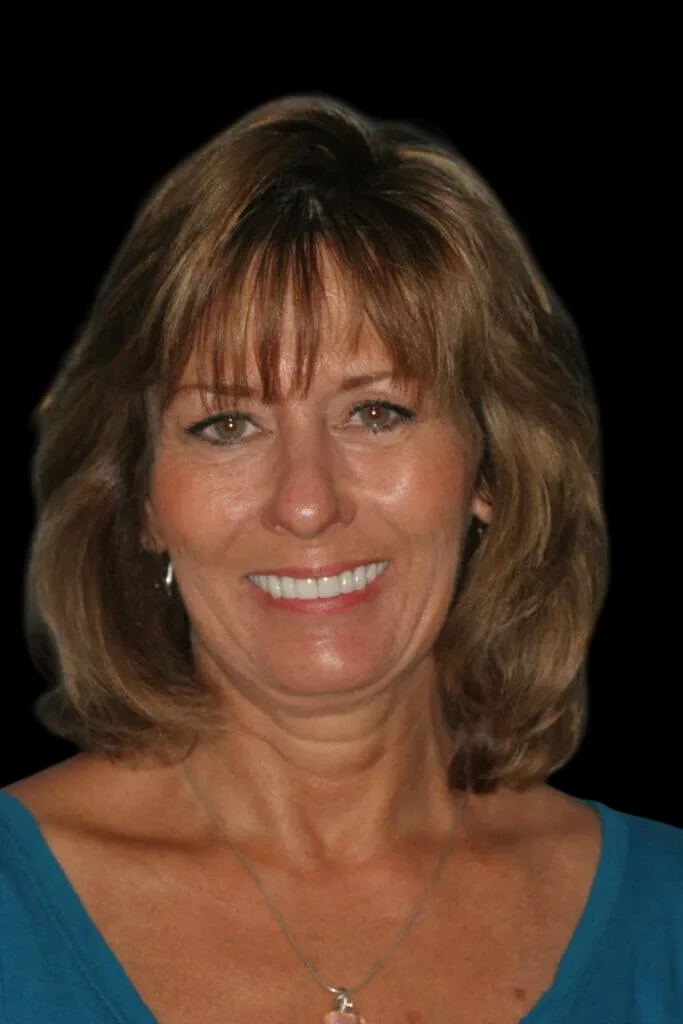 A result from Lasting Smiles Dental Implant Center