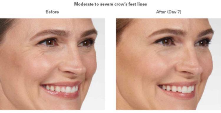 A result from Best Impression Med Spa