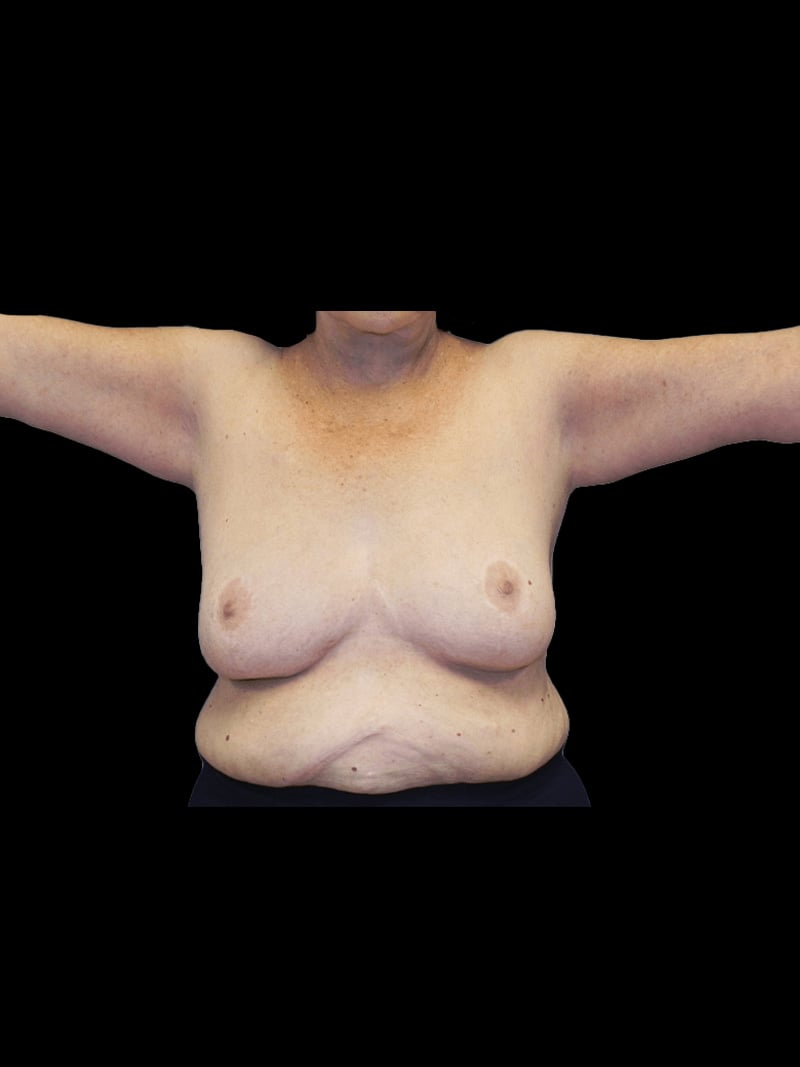 PRMA Plastic Surgery | Center For Advanced Breast Reconstruction provider photo