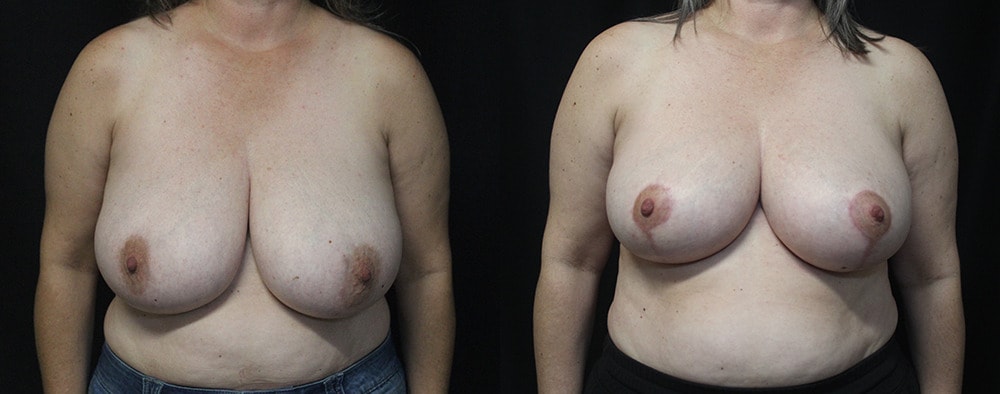 A result from Lynn Chung, MD