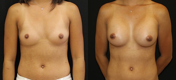 A result from Lynn Chung, MD