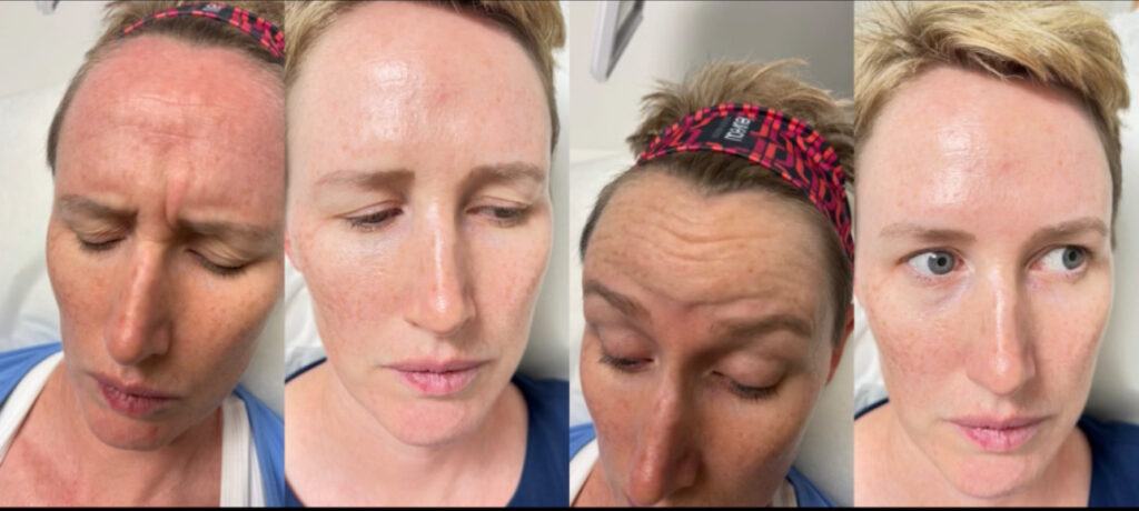 A result from Estar MedSpa & Innovative Health Center