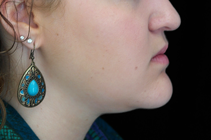 Plastic Surgery, Pittsburgh PA: Dr. Anna Wooten, Beleza Plastic Surgery & Med Spa provider photo