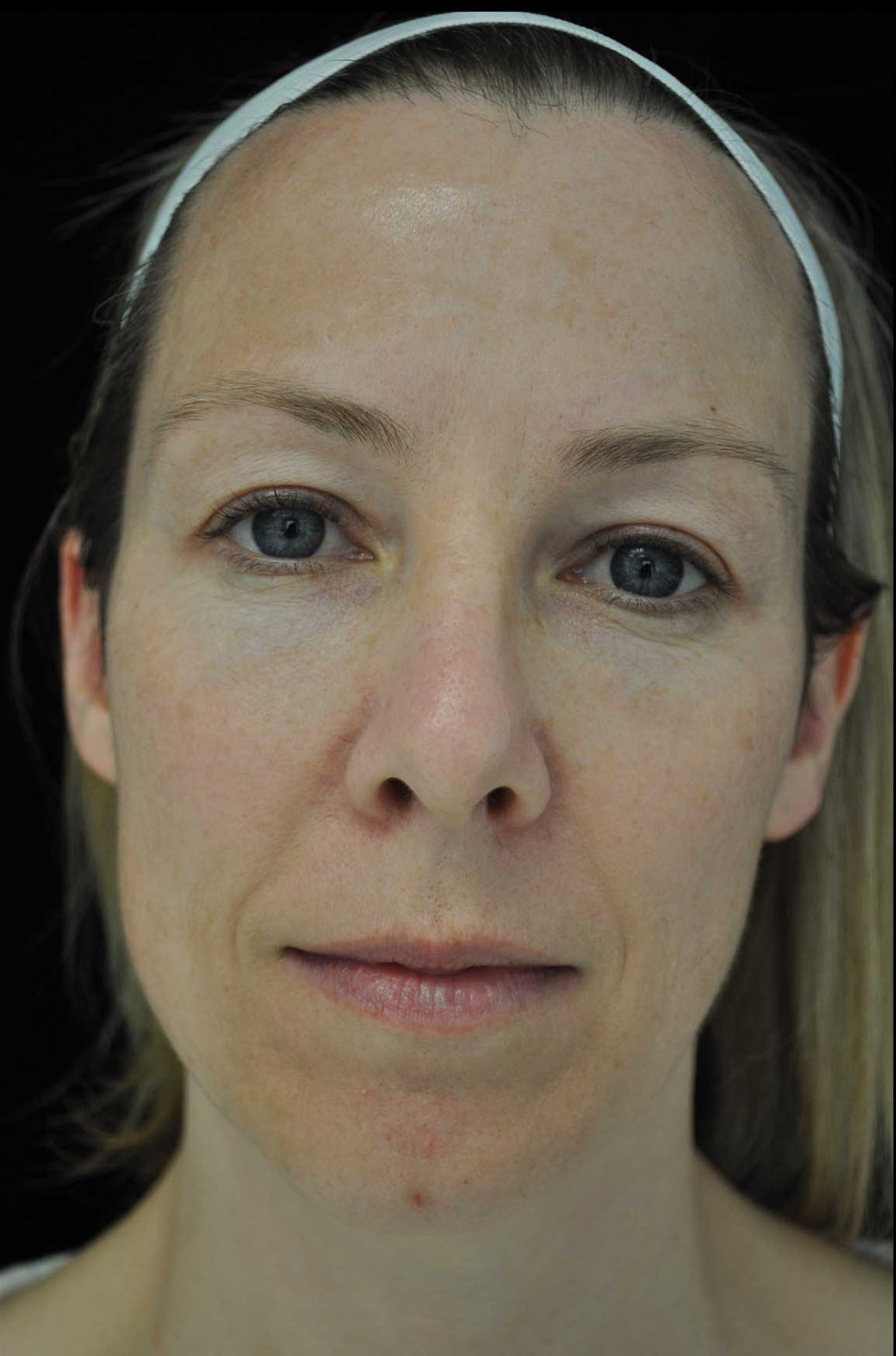Plastic Surgery, Pittsburgh PA: Dr. Anna Wooten, Beleza Plastic Surgery & Med Spa provider photo