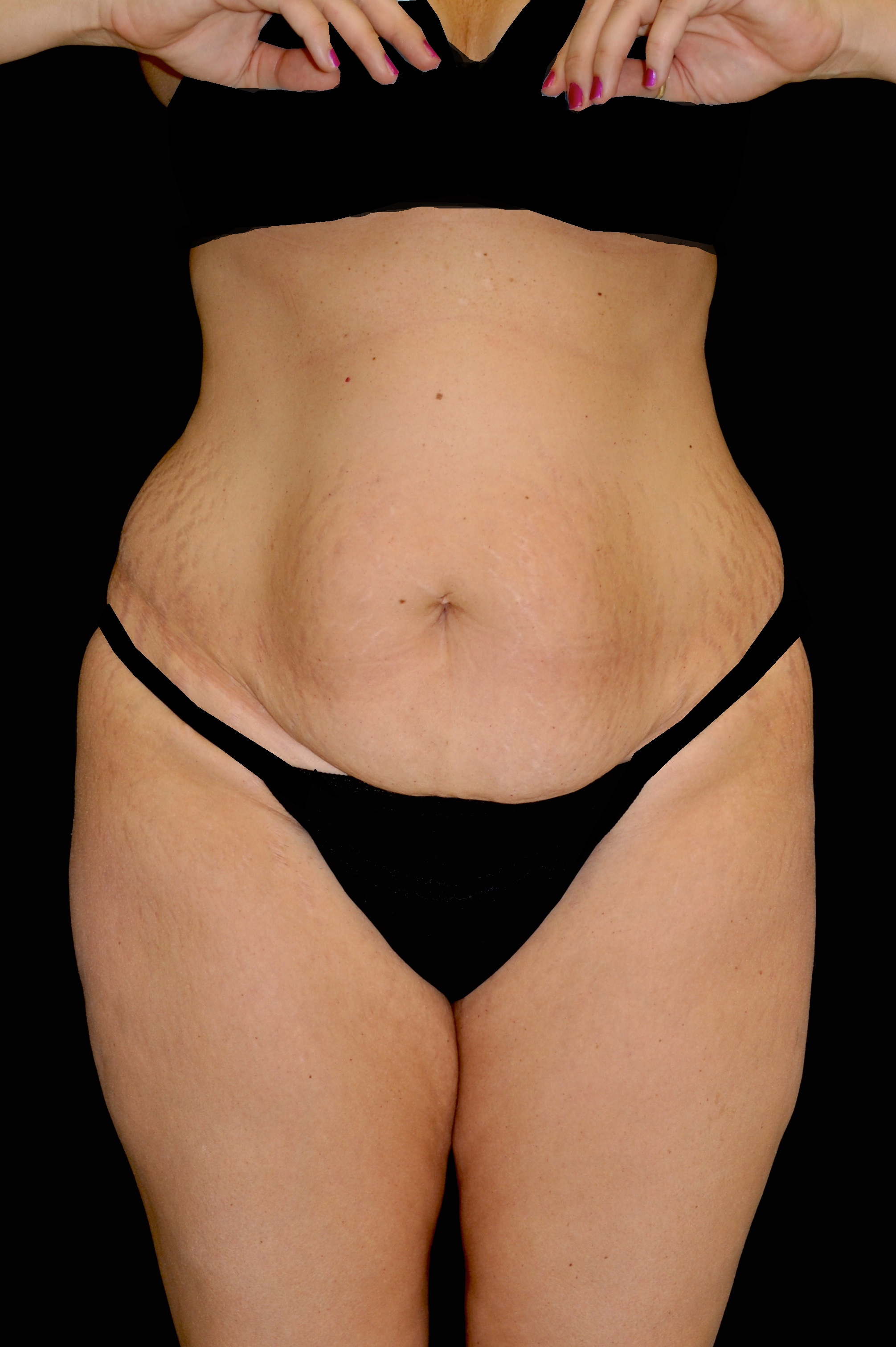 Plastic Surgery, Pittsburgh PA: Dr. Anna Wooten, Beleza Plastic Surgery & Med Spa provider photo