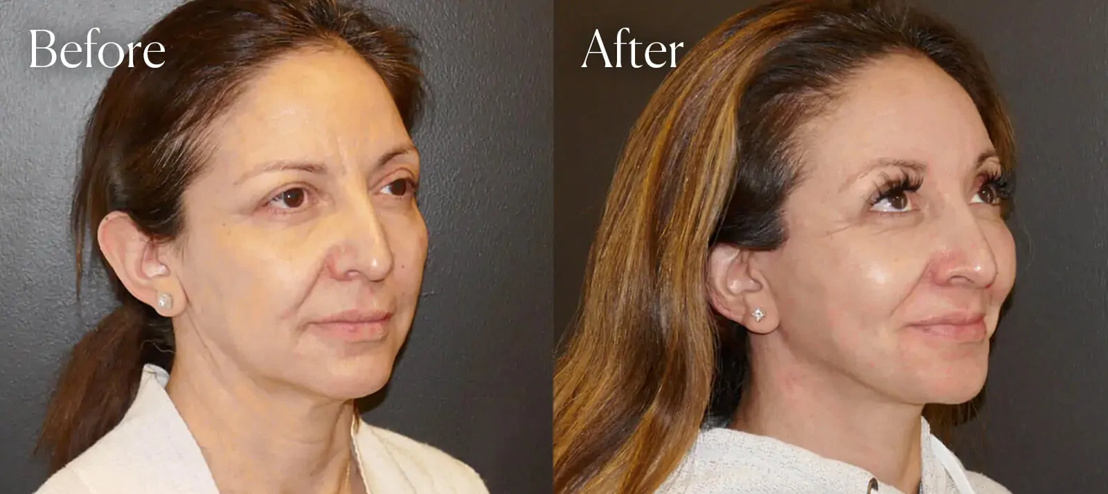 Shah Aesthetic Surgery - Rhinoplasty and Facelift Specialist provider photo
