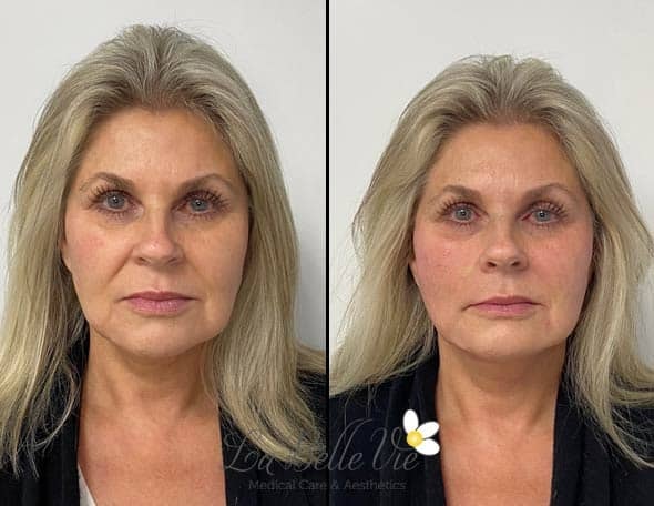 A result from La Belle Vie Medical Care & Aesthetics