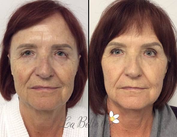 A result from La Belle Vie Medical Care & Aesthetics