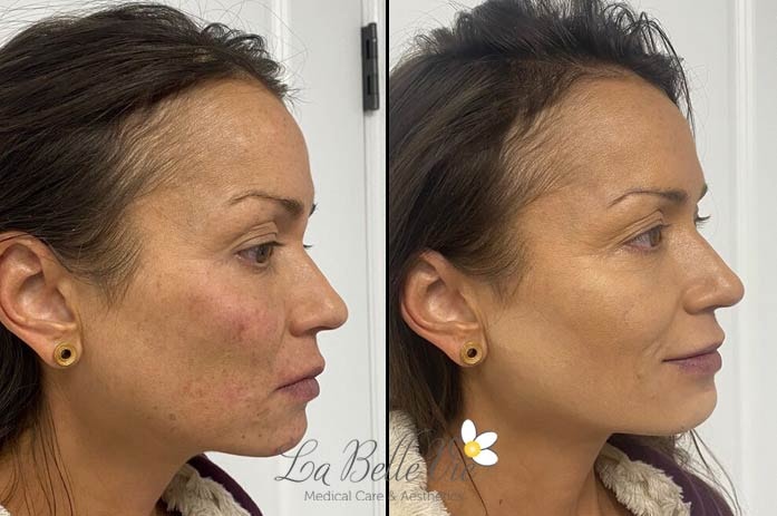 A result from La Belle Vie Medical Care & Aesthetics