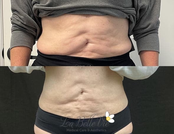 A result from La Belle Vie Medical Care & Aesthetics