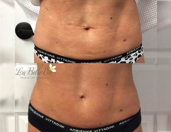 A result from La Belle Vie Medical Care & Aesthetics