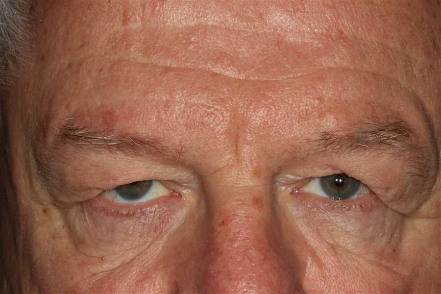 Klapper Eyelid & Facial Plastic Surgery provider photo