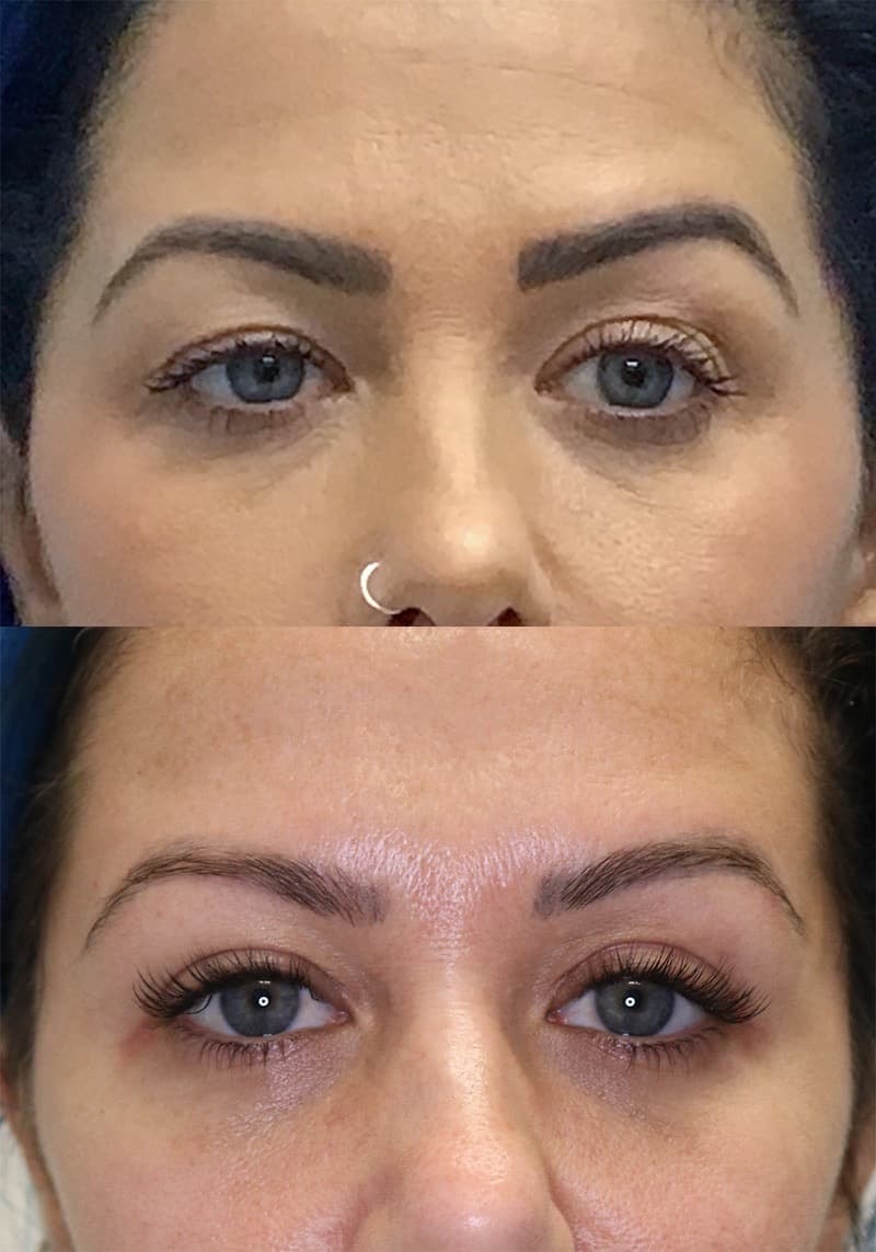 A result from Jose Rodríguez-Feliz, MD