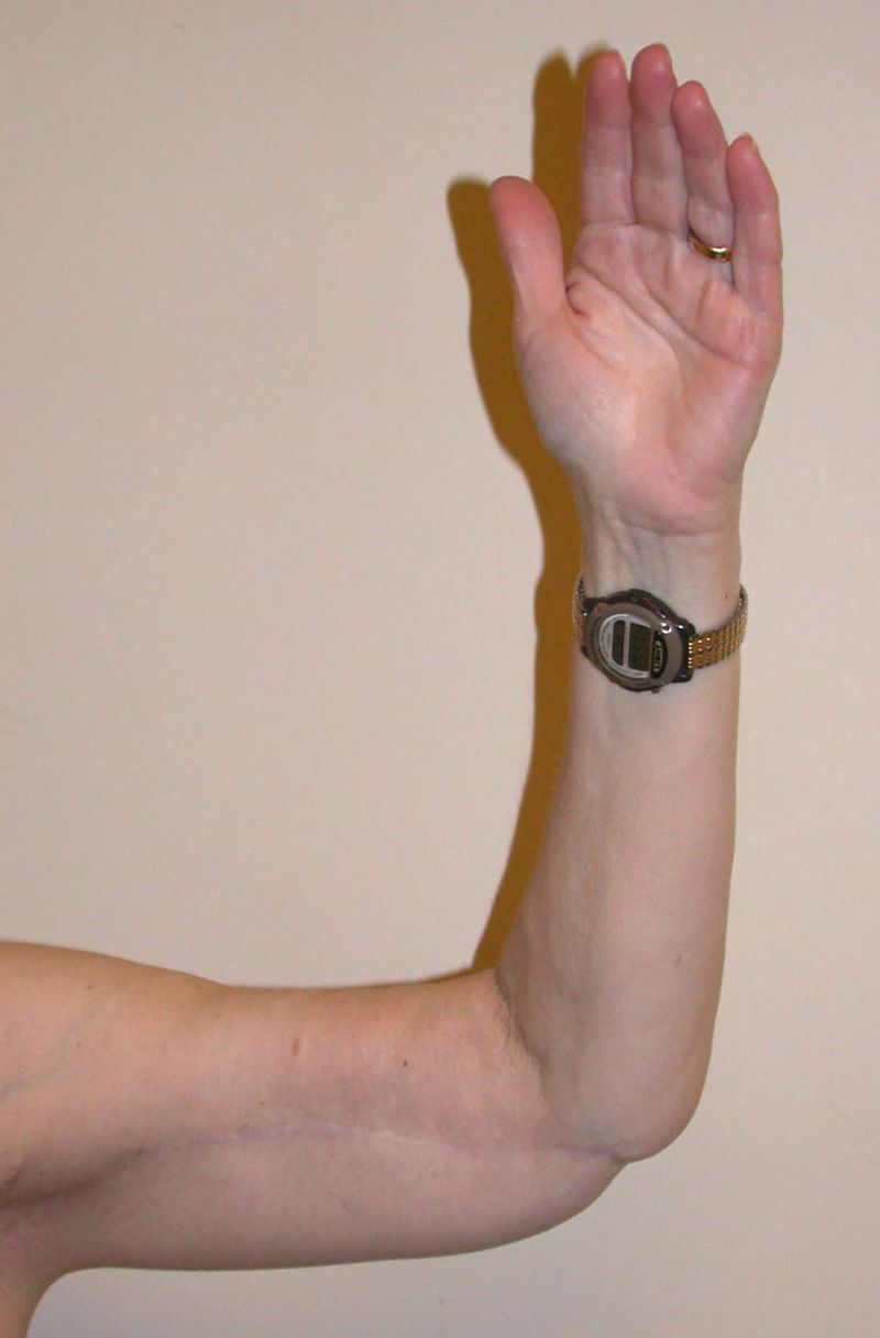 A result from Dr. Kenneth Bermudez, MD