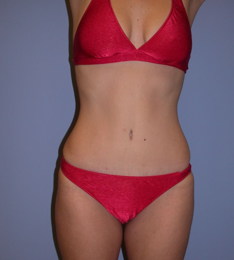 A result from Dr. Kenneth Bermudez, MD