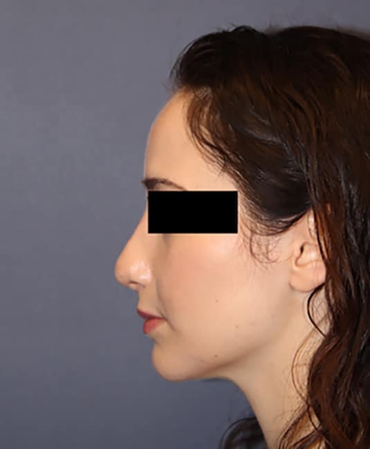 A result from Samuel Lin, MD, FACS