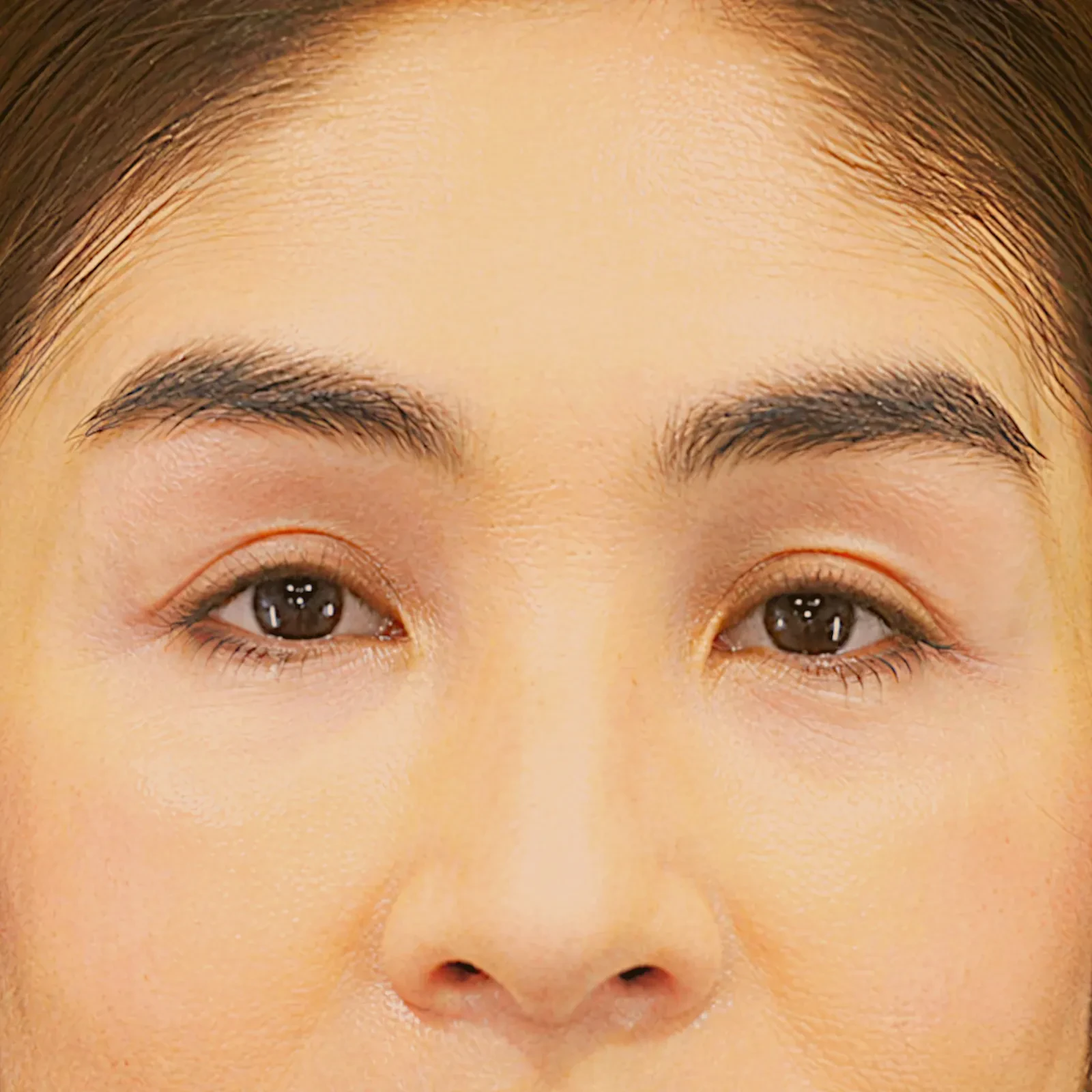 A result from Fulcrum Aesthetics and Surgery
