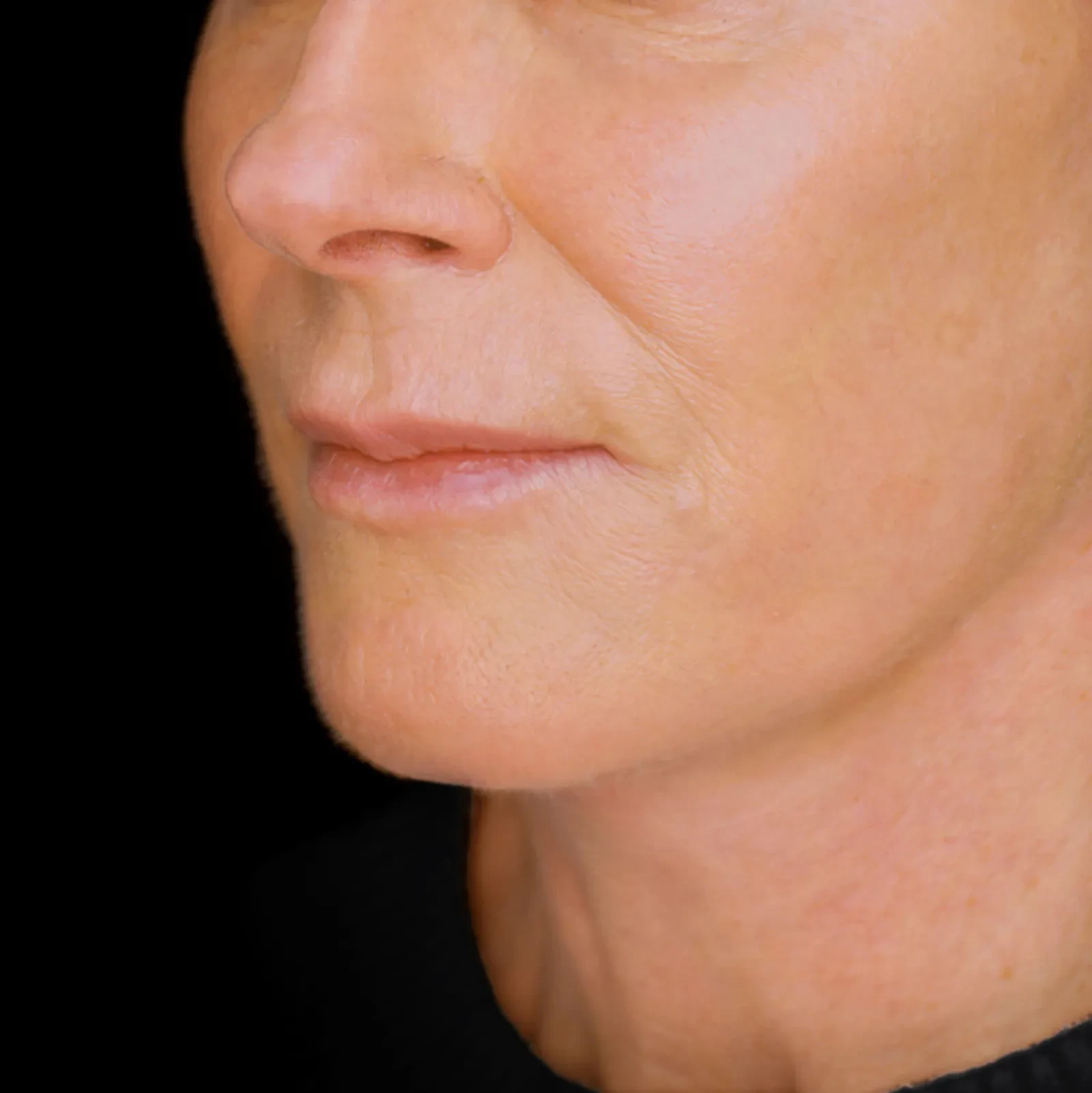 A result from Fulcrum Aesthetics and Surgery