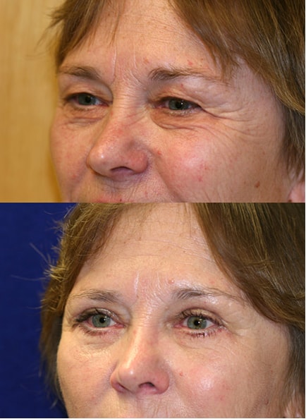 A result from Patel Plastic Surgery
