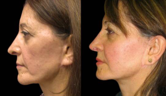 Bitar Cosmetic Surgery Institute & Medspa provider photo