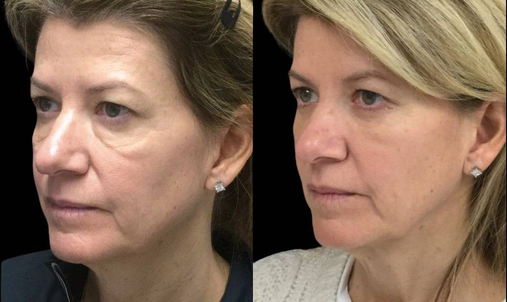 Bitar Cosmetic Surgery Institute & Medspa provider photo