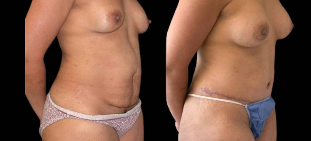 Bitar Cosmetic Surgery Institute & Medspa provider photo