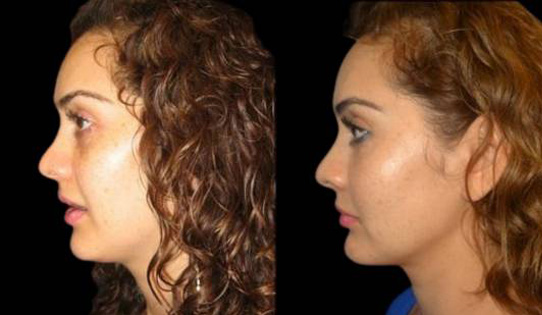 Bitar Cosmetic Surgery Institute & Medspa provider photo