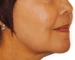Suddenly Slimmer Med Spa provider photo