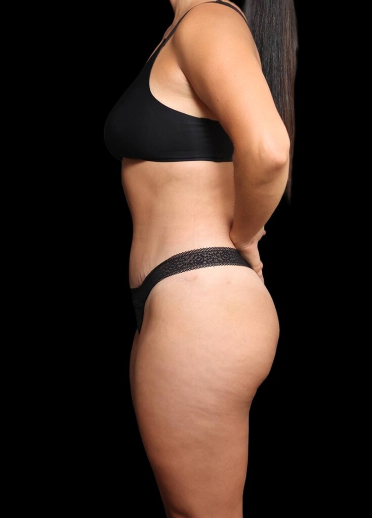A result from Garlick Plastic Surgery
