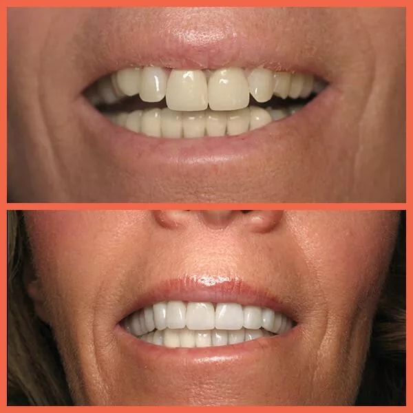 A result from Legacy Dental