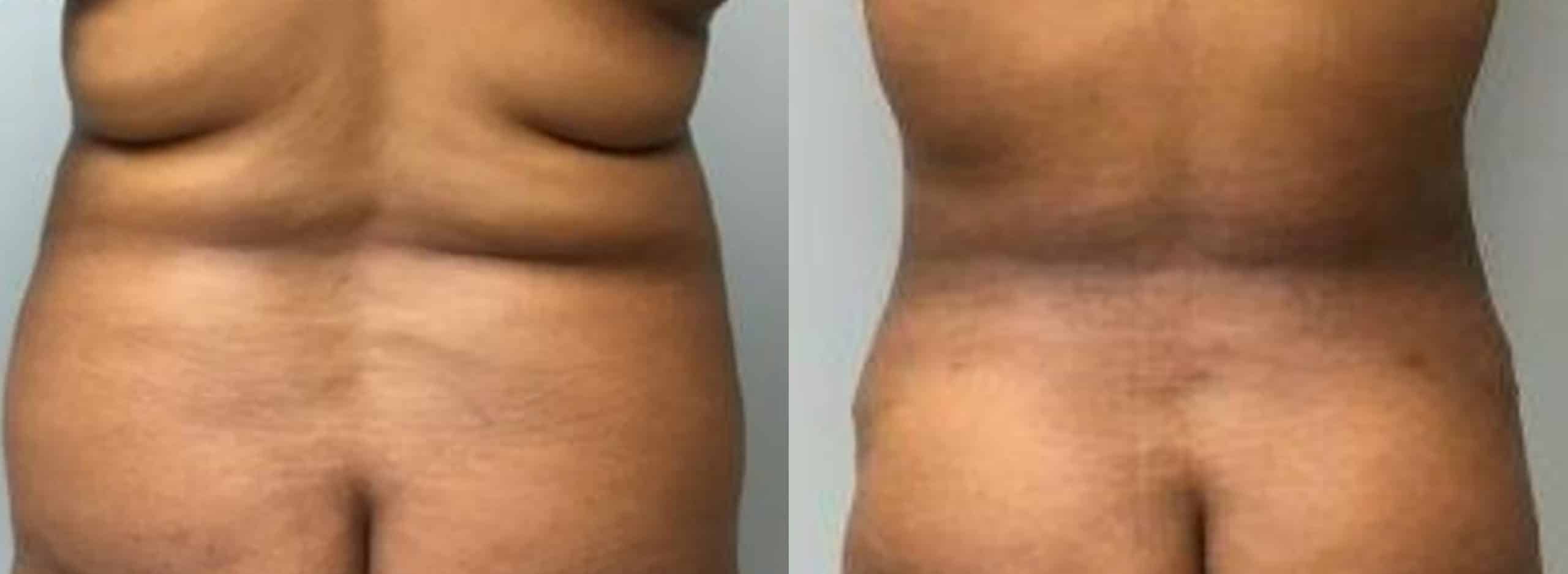 A result from John Reilly MD Plastic Surgeon
