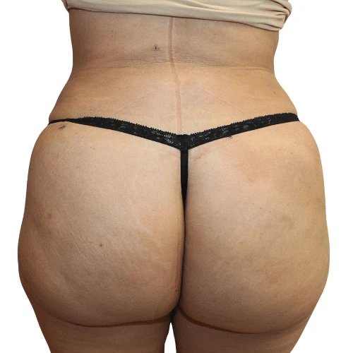 A result from Estea Cosmetic