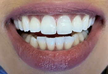 Preston Bend Dental provider photo