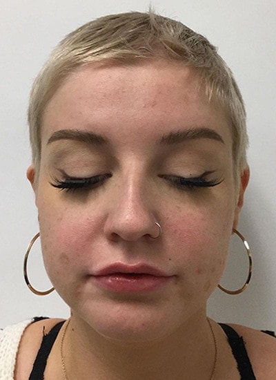 A result from Augusta Aesthetics