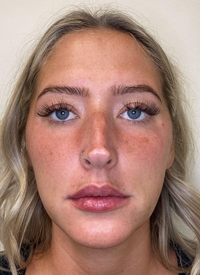 A result from Augusta Aesthetics