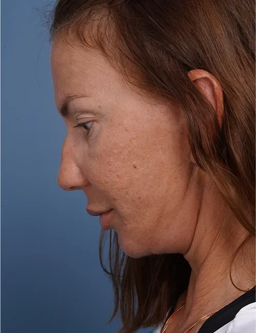 A result from Justin Bellamy, MD