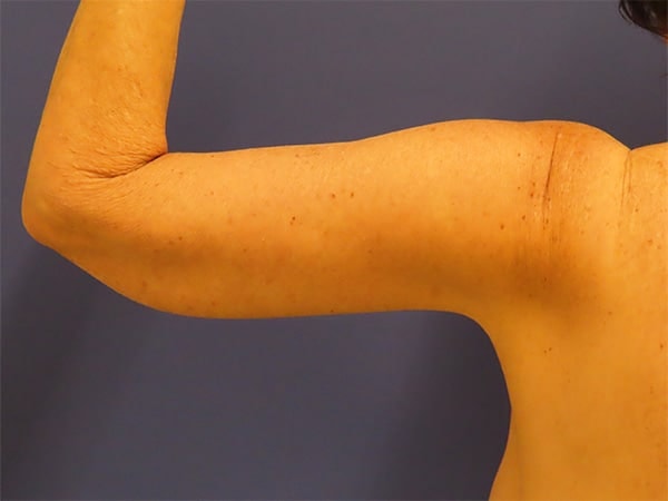 A result from Robert Kearney, MD, FACS