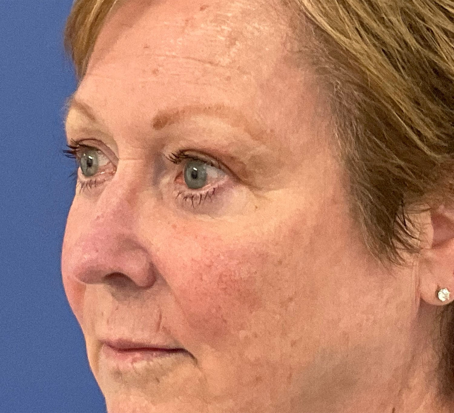 A result from Robert Kearney, MD, FACS