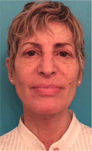 A result from Luxurgery
