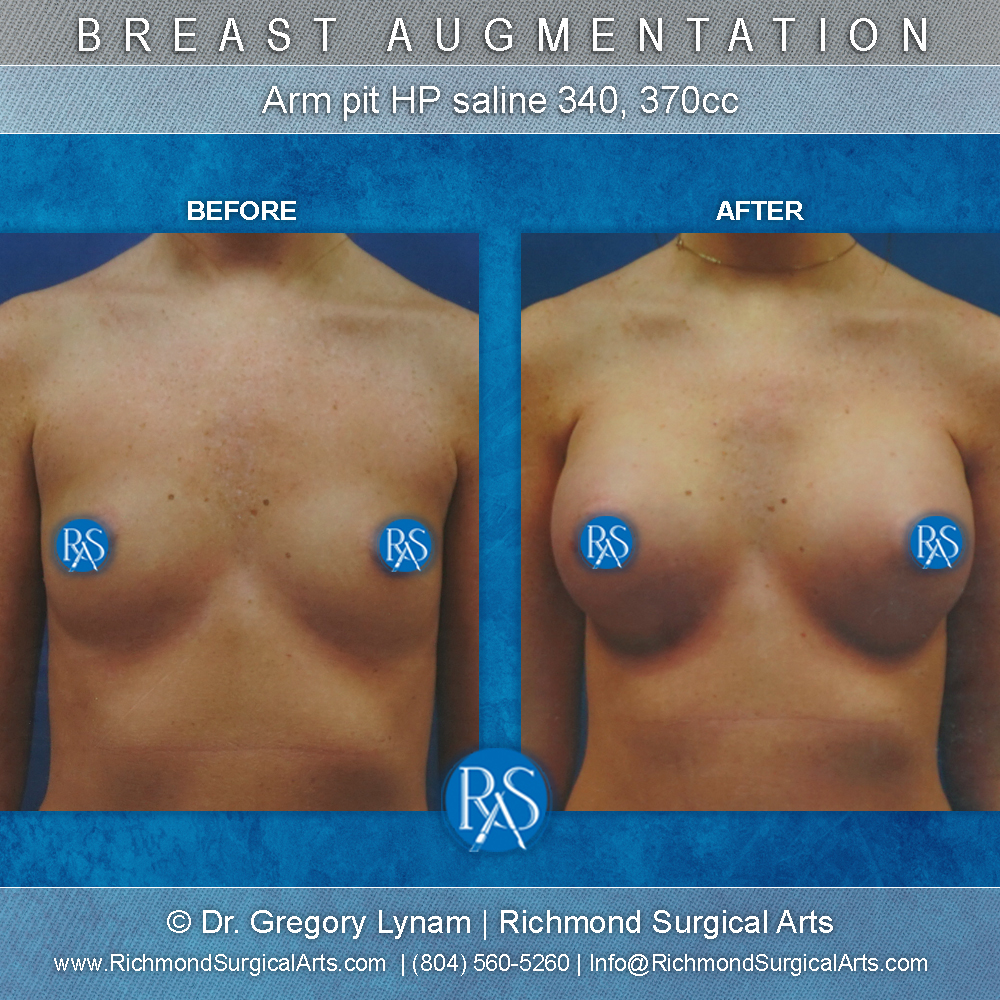 Richmond Surgical Arts provider photo