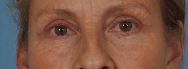 A result from StarkMD Plastic Surgery & Aesthetic Center