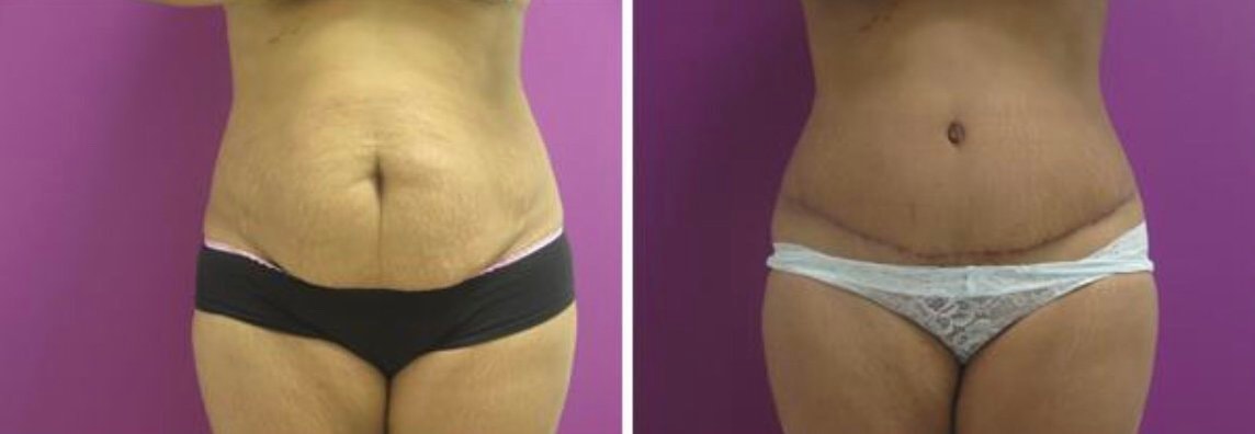A result from Town Plastic Surgery